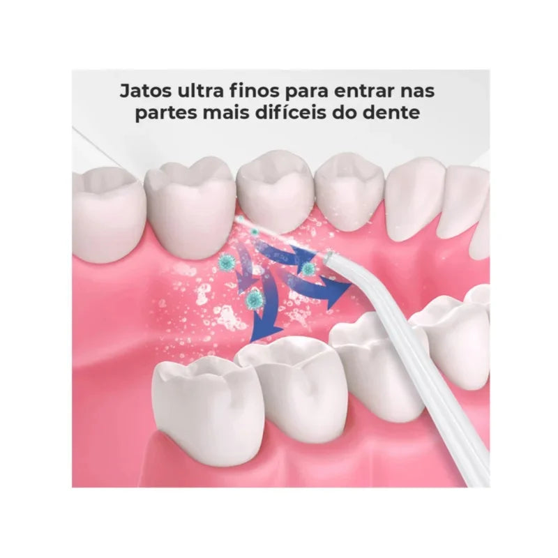 Sorriso Turbo